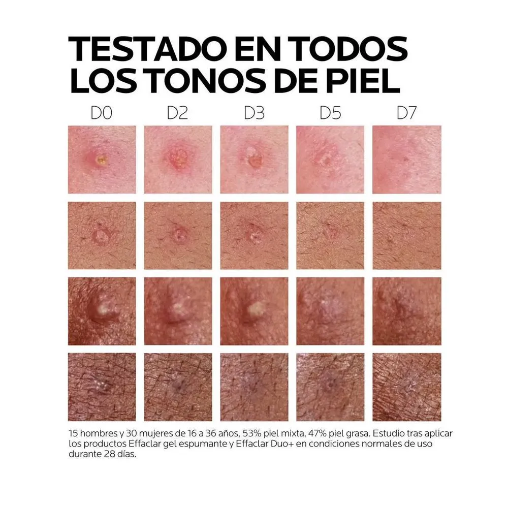EFFACLAR DUO [+M] x 40 - Imagen 3