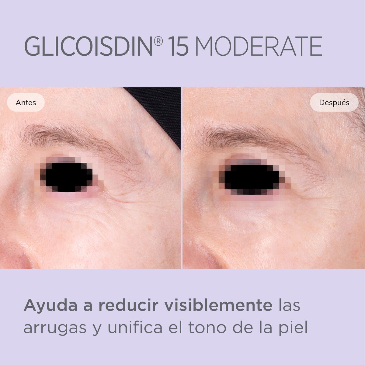 ISDIN GLICOISDIN GEL (MODERATE) 15% x 50 - Imagen 4