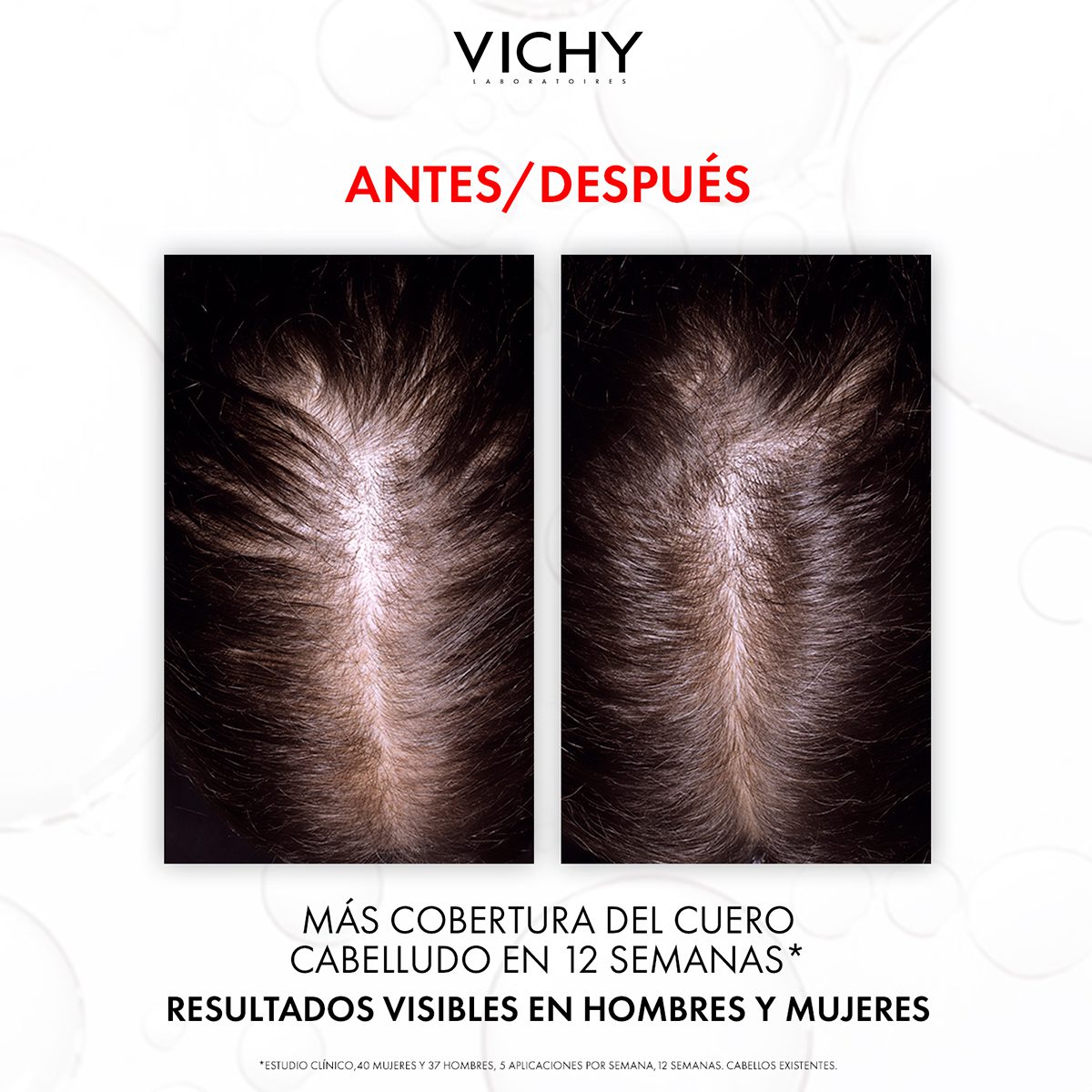 VICHY DERCOS AMINEXIL SERUM ANTICAIDA X90 - Imagen 5